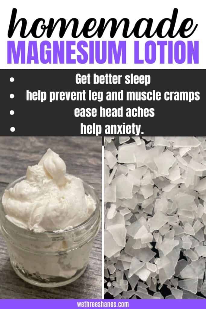 This DIY magnesium lotion is simple to make and has many health benefits for the body including better sleep and less anxiety.| We Three Shanes