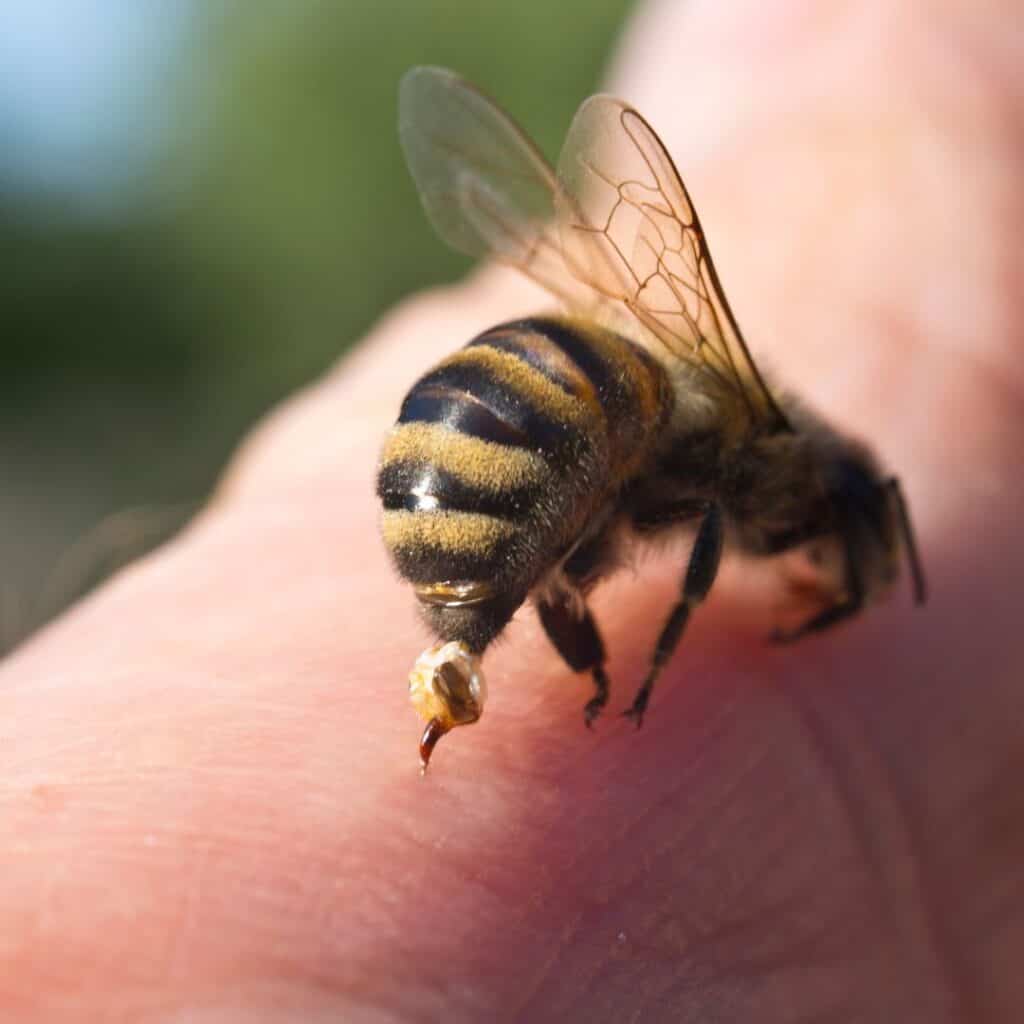 picture of a bee stinging a human