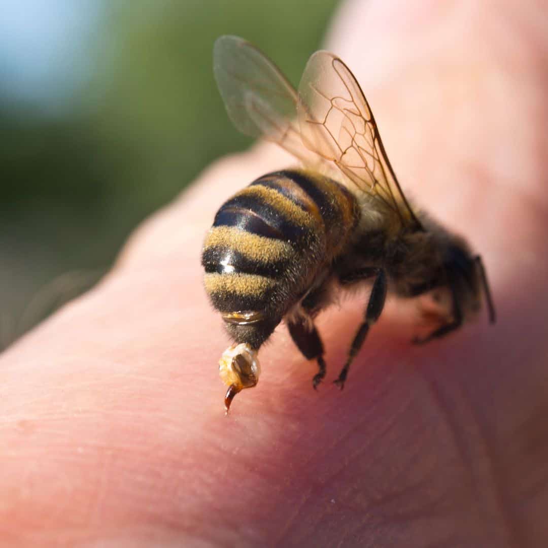 Natural Home Remedies For Bee Stings