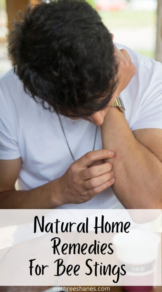 Natural home remedies for bee stings that you can easily do at home.  Wethreeshanes.com